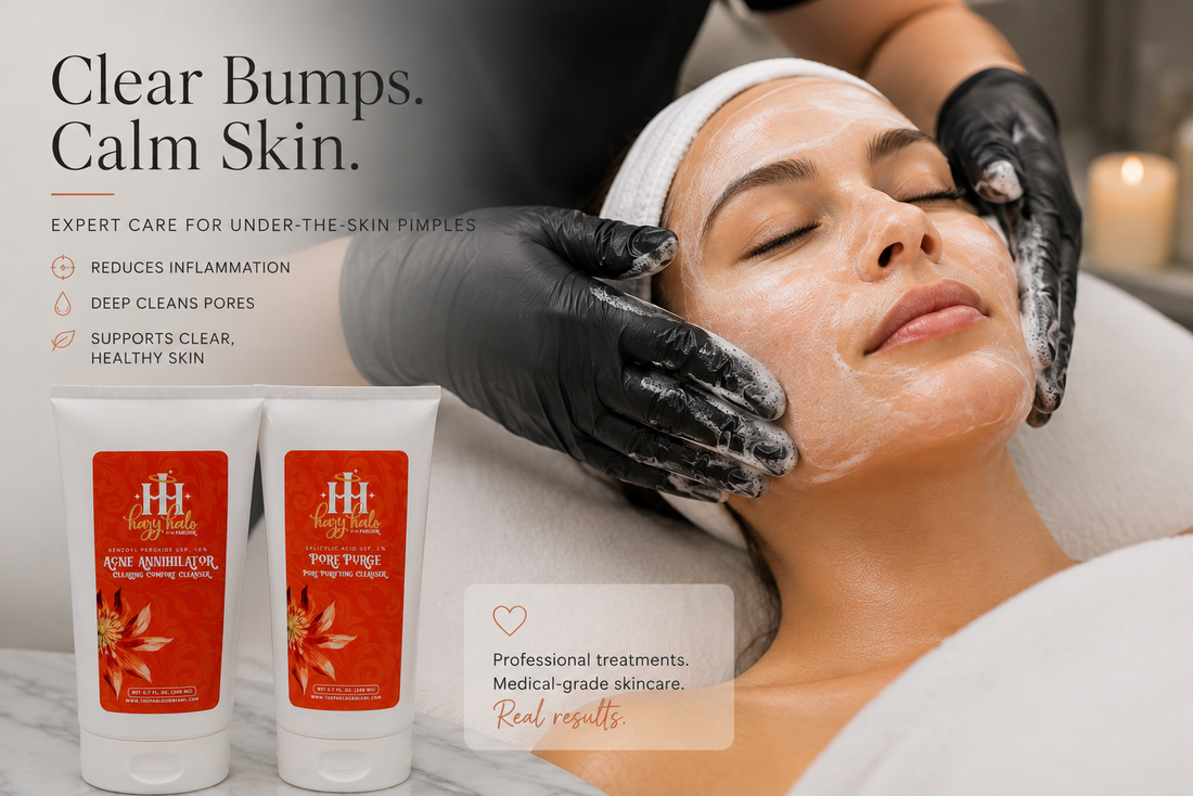 How to Get Rid of Under-the-Skin Pimples Fast